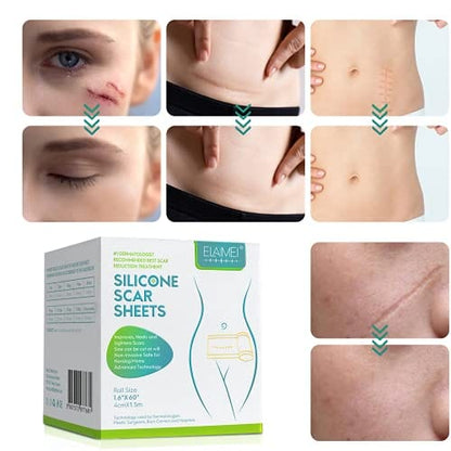 Dermoxy™ Scar Removal Tape
