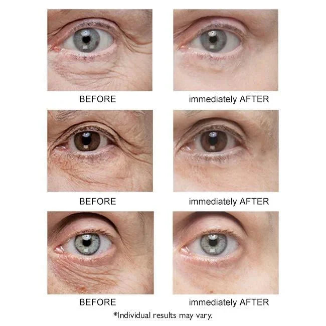 Instant Firm Eye Bag Cream (Pack Of 2)